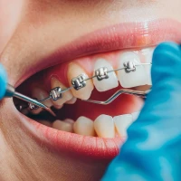 متى تحتاج إلى زيارة طبيب الأسنان؟